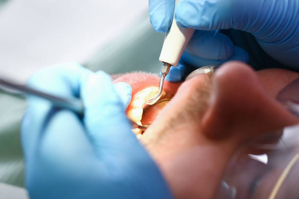 Best Weekend Emergency Dentist in Waverly, OH