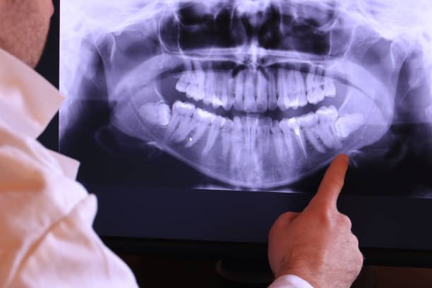 Best Emergency TMJ Treatment in Waverly, OH