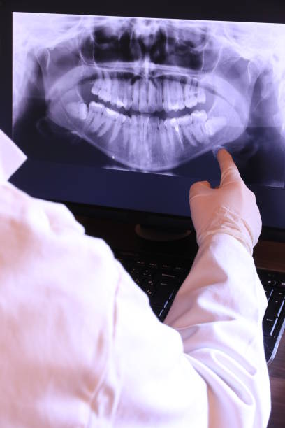 Best Emergency Tooth Extraction in Waverly, OH
